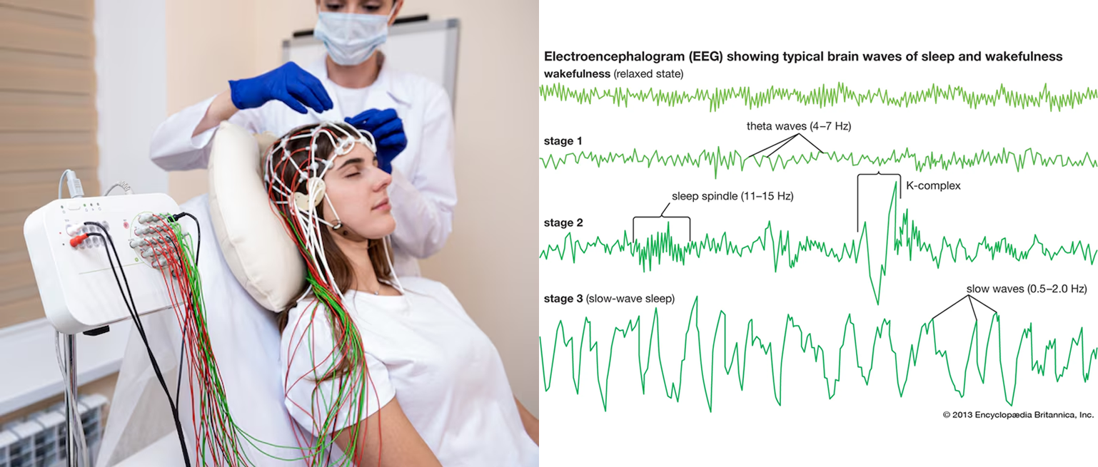 EEG